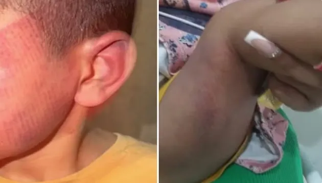Mulher diz que namorado espancou e deixou marcas de chinelada nos filhos do casal por não aceitar término: 'Nunca imaginei que ele fosse capaz'