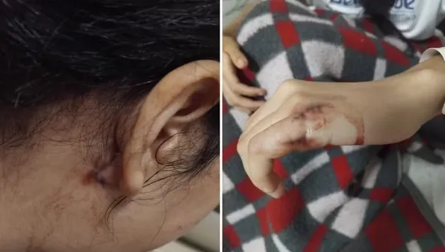 Pai de menina esfaqueada dentro de sala de aula diz que filha não quer voltar à escola: 'Revolta, insegurança e frustração'