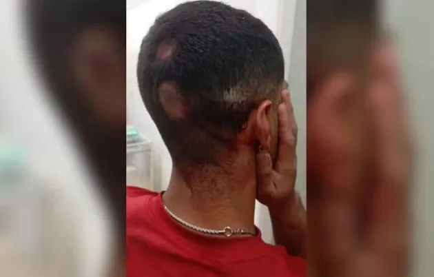 Comerciário é agredido por grupo vestido de verde e amarelo ao comemorar vitória de Lula em praça