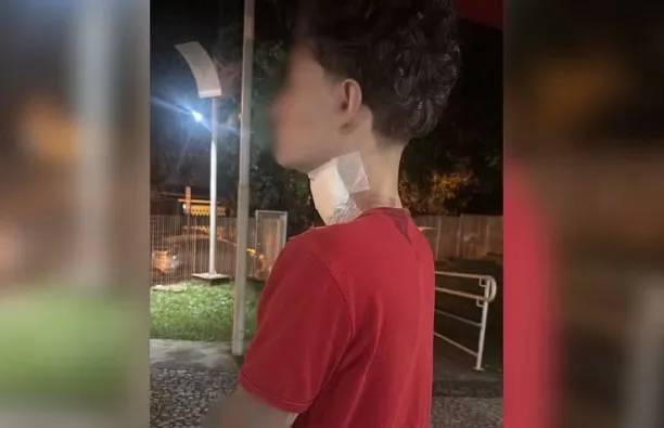 Motociclista recebe 35 pontos no pescoço após ser atingido por linha com cerol 