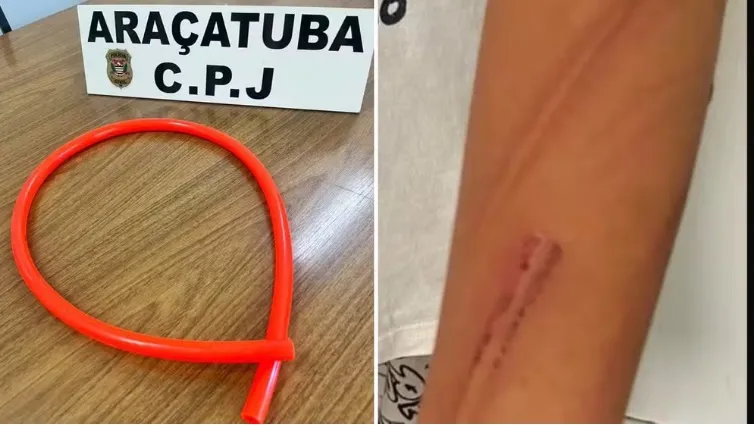 Homem é preso por maus-tratos após espancar enteado com pedaço de mangueira